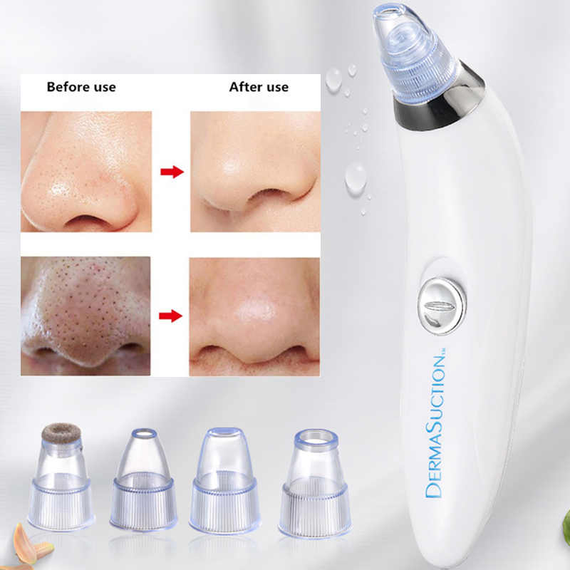 Electric Pore Cleaner & Blackhead Remover