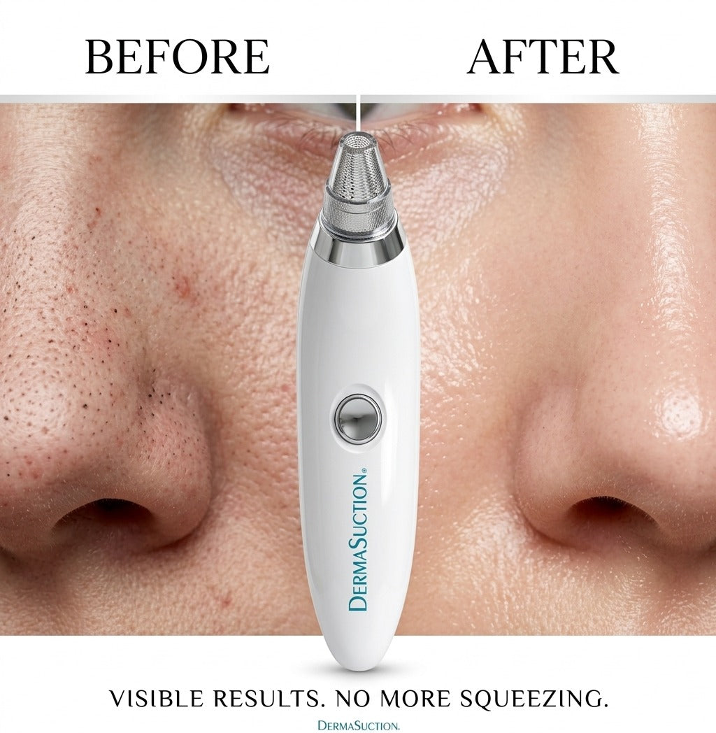 Electric Pore Cleaner & Blackhead Remover